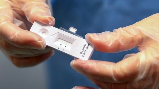 Covid-19: Comparticipação de testes a 100% alargada até final de agosto