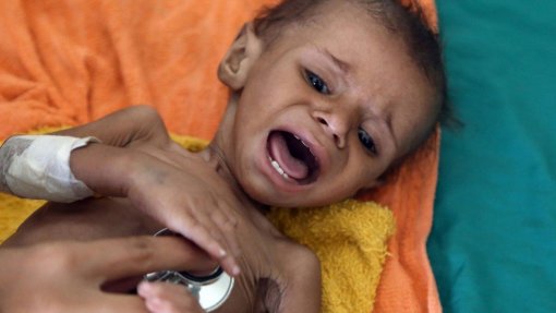 Afeganistão: UNICEF antevê que metade das crianças afegãs sofrerão de desnutrição severa este ano