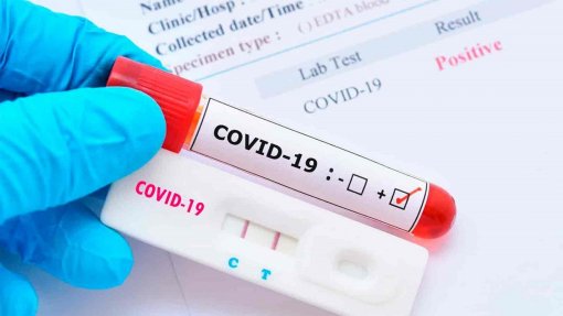 Covid-19: Portugal regista 1.778 novos casos, 10 mortes e menos 29 internados