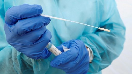 Covid-19: Mais 1.247 infeções, 10 mortes e menos doentes internados nas últimas 24 hora