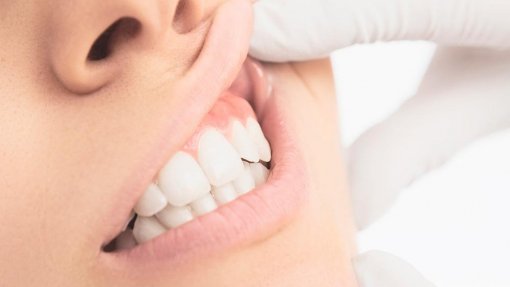 Diabetes dificulta o tratamento de infeções dentárias