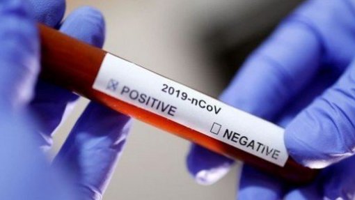 Covid-19: Seis mortes e 755 novos casos de infeção em Portugal nas últimas 24 horas