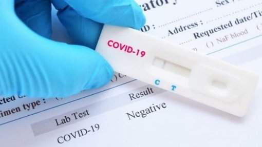 Covid-19: Açores vão deixar de pagar testes aos laboratórios nacionais