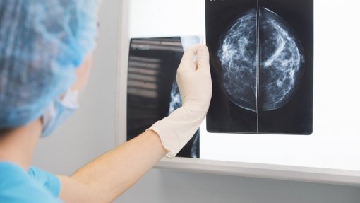 Projeto inovador pretende soluções para a deteção e tratamento do cancro da mama