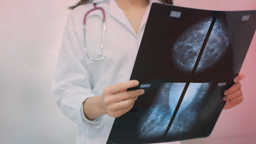 Há “bastante a fazer” na reintegração de sobreviventes do cancro da mama - SPS
