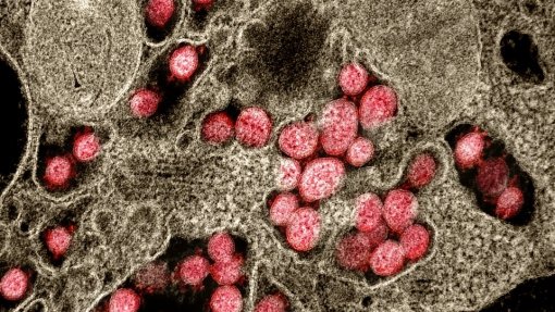 Covid-19: Vírus pode ser sazonal com relação com baixas temperaturas – estudo