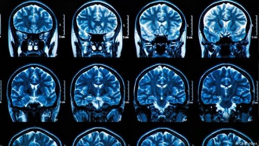 Projeto sobre doenças neurológicas vence prémio da Agência Nacional de Inovação
