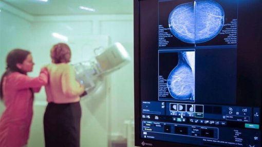 Mais de 4.000 doentes com cancro ficaram por diagnosticar no último ano - Estudo