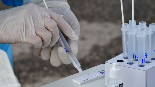 Covid-19: Açores com 18 novos casos e 21 recuperações nas últimas 24 horas