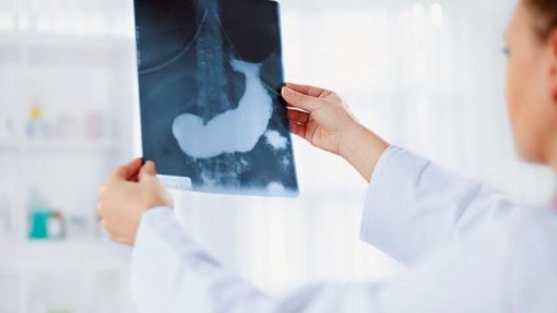 Incidência do cancro do pâncreas está a aumentar e a ser detetado em mais jovens