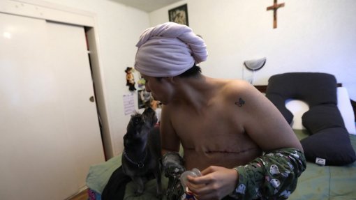 Cancro de mama com impacto elevado na vida dos doentes, quase metade recorreu a apoio psicológico