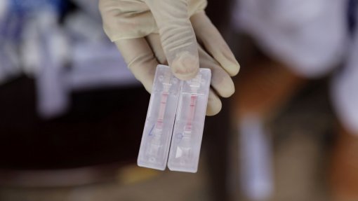 Covid-19: Estudo reforça valor das medidas de saúde pública para controlar pandemia