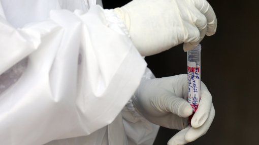 Covid-19: Realização de testes rápidos de antigénio gratuitos abrange toda a população