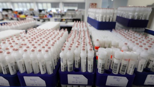 Covid-19: Portugal realizou 117 mil testes na terça-feira, novo máximo em 24 horas