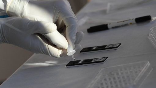 Covid-19: Três farmácias de Beja já disponibilizam testes de antigénio gratuitos