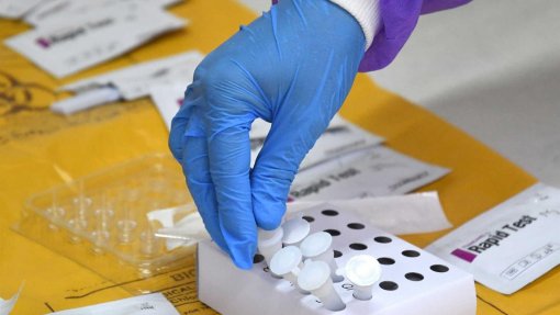 Covid-19: Açores com mais 23 novos casos e 23 recuperações