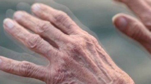 Prémio João Lobo Antunes distingue investigadora que vai testar realidade virtual em doentes de Parkinson