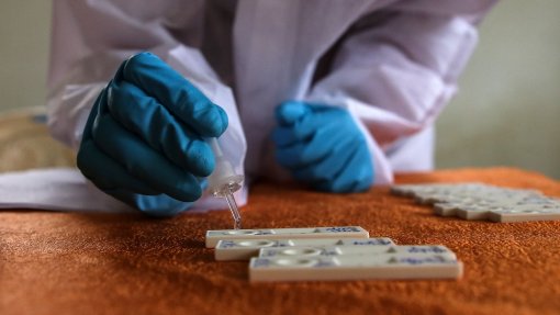 Covid-19: Açores registam 10 casos de contaminação