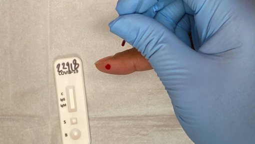 Covid-19: Açores com mais 25 novos casos de infeção e 26 recuperações
