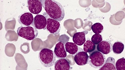 Investigadores de Portugal e do Brasil descobrem mutação genética que causa leucemia aguda