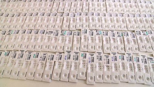 Covid-19: Açores detetaram 45 casos de infeção com a variante Ómicron
