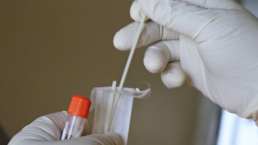Covid-19: Número recorde de mais de 15 milhões de infeções no mundo na semana passada - OMS