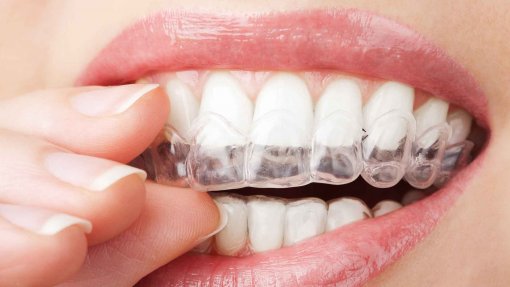 Ordem lança campanha de alerta para perigo de compra de aparelhos dentários na net