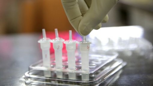Covid-19: Mundo regista novo recorde de infeções com 3,84 milhões de casos nas últimas 24 horas