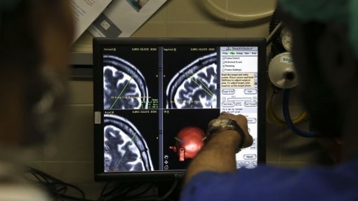 Estudo sobre neuropatia aponta novas formas de tratamento para doença de Parkinson