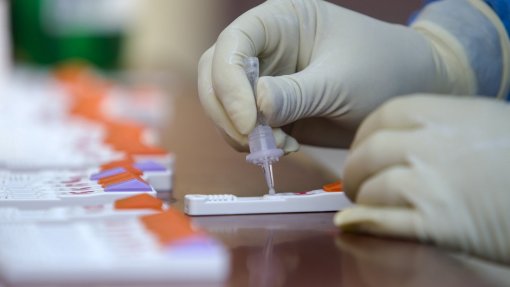 Covid-19: Açores com 671 novos casos e um óbito nas últimas 24 horas