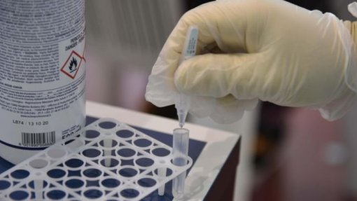 Covid-19: Açores com 577 novos casos e 1.159 recuperações