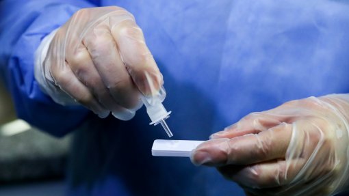 Covid-19: Açores com 554 novos casos e dois óbitos