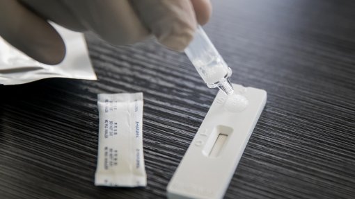Covid-19: Autotestes devem apresentar rotulagem e instruções em português - Infarmed