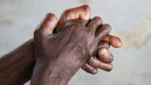 “Os doentes de lepra têm medo de contar à família”       