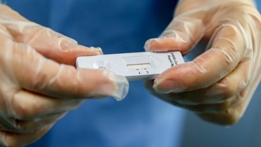 Covid-19: Açores com 2.603 novos casos e um óbito na última semana