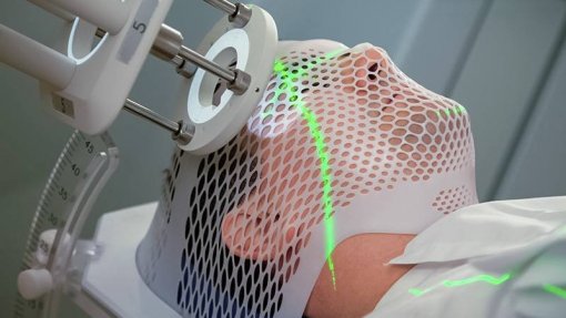 Cientistas identificam medicamento que pode reverter resistência à radioterapia cerebral