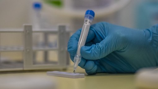 Covid-19: Açores com 2.411 novos casos e um óbito na última semana