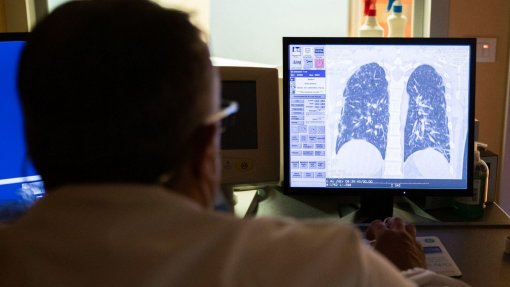 Mais de metade desvaloriza a asma e três em cada quatro não conhece todos os sintomas