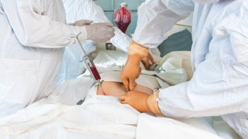 Transplantado da medula em Portugal gasta até 100 euros/mês em medicação - associação