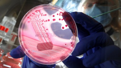 Investigadores alertam que &#039;Acinetobacter baumannii&#039; é uma &quot;ameaça&quot; em hospitais