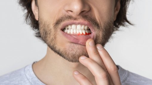 Dentistas realizam ação de rua para sensibilizar para perigos das doenças das gengivas