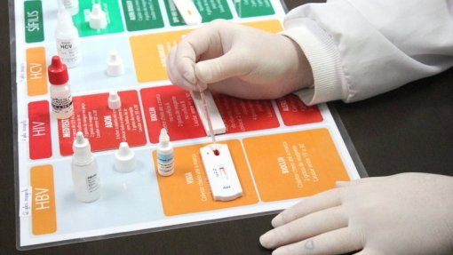 Mais de 1,1 milhões de testes para VIH e hepatites B e C no ano passado