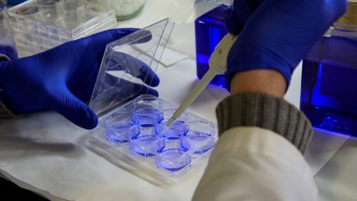 Cinco casos confirmados de infeção pelo vírus Monkeypox, há outros 15 suspeitos