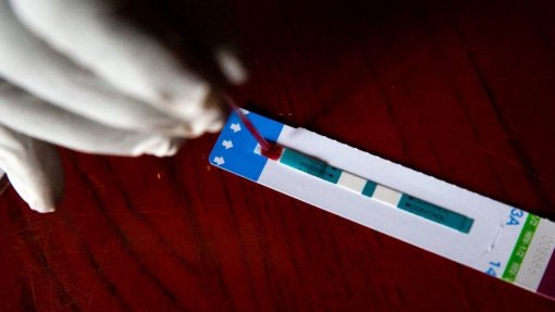 Menos 30% de seropositivos em tratamento na Ucrânia devido à guerra