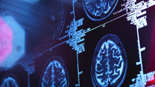 Imagens sintéticas melhoram diagnóstico e tratamento de tumores cerebrais malignos - estudo