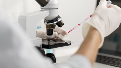 Investigadores liderados por portuguesa identificam novo biomarcador para prognóstico de cancro da mama