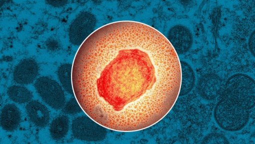 Monkeypox: Mais 21 casos registados faz aumentar para 297 pessoas infetadas - DGS