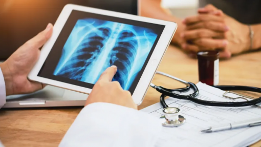 Mais de um milhão de resultados de exames médicos disponíveis digitalmente desde maio
