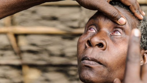 Maláui é o primeiro da África Austral a eliminar o tracoma - OMS