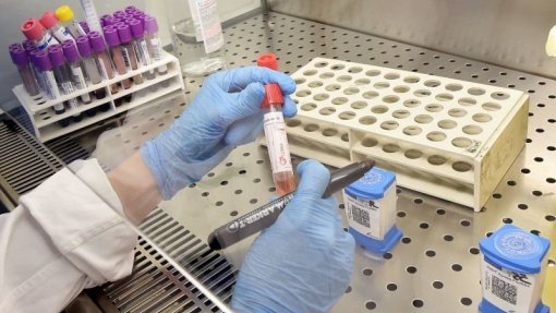 Laboratório da Universidade de Coimbra realiza todo o tipo de análises clínicas